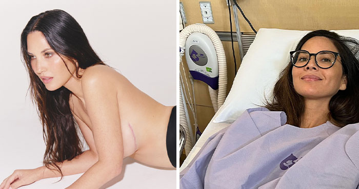 “A Warrior!”: Olivia Munn Praised For Proudly Showing Mastectomy Scars In New Photoshoot