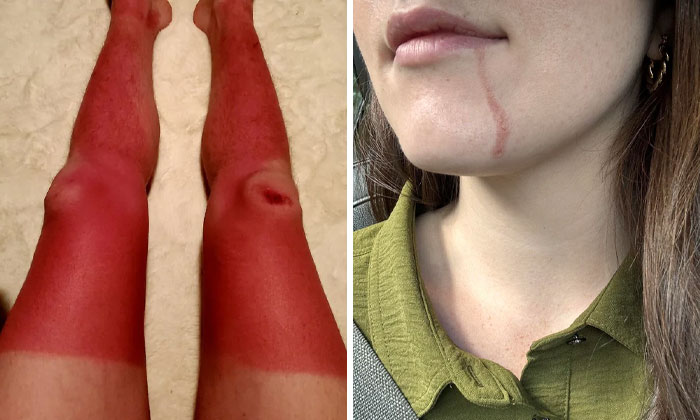 If You Think You’re Having A Terrible Day, These People Beg To Differ (New Pics)