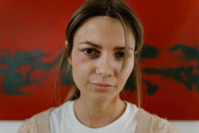 30 Times People Injured Themselves In Dumb Ways And Just Had To Warn Others