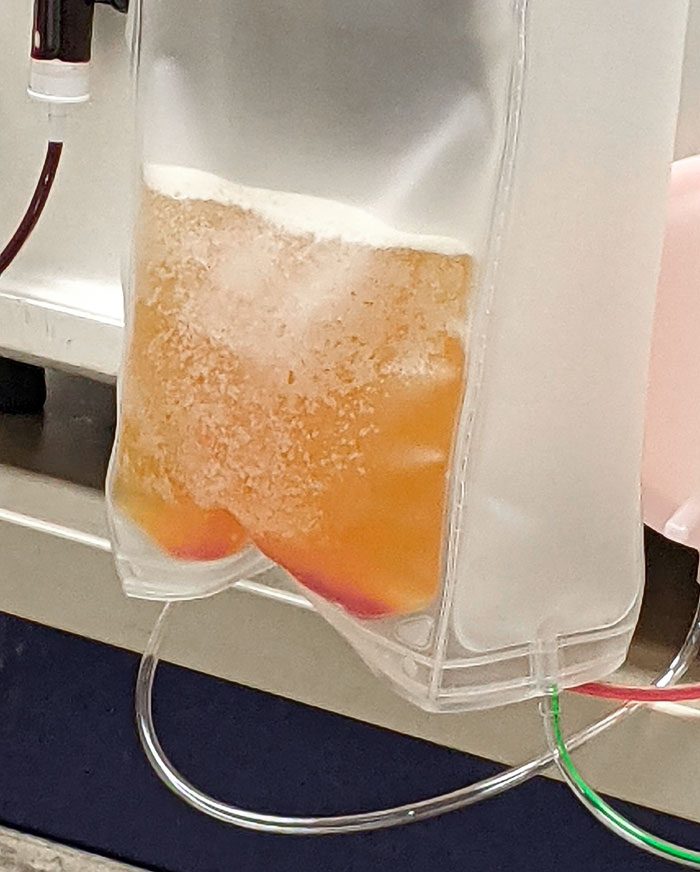 What Blood Looks Like With The Red Blood Cells Removed