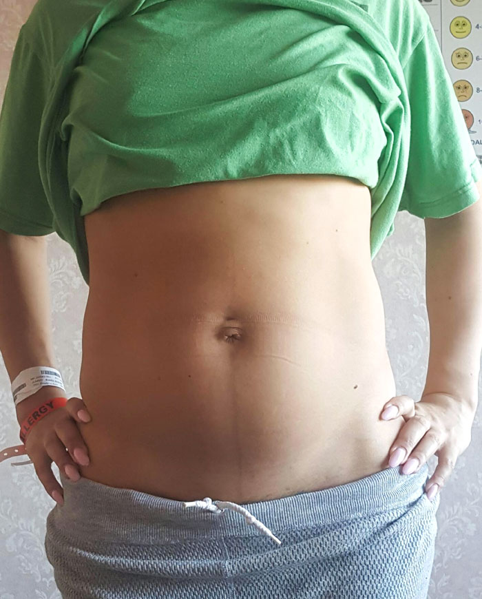 This Is My Girlfriend 4 Hours After Giving Birth