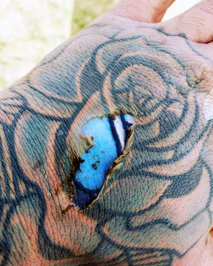 Burn Mark On Hand Reveiles Fresh Tattoo
