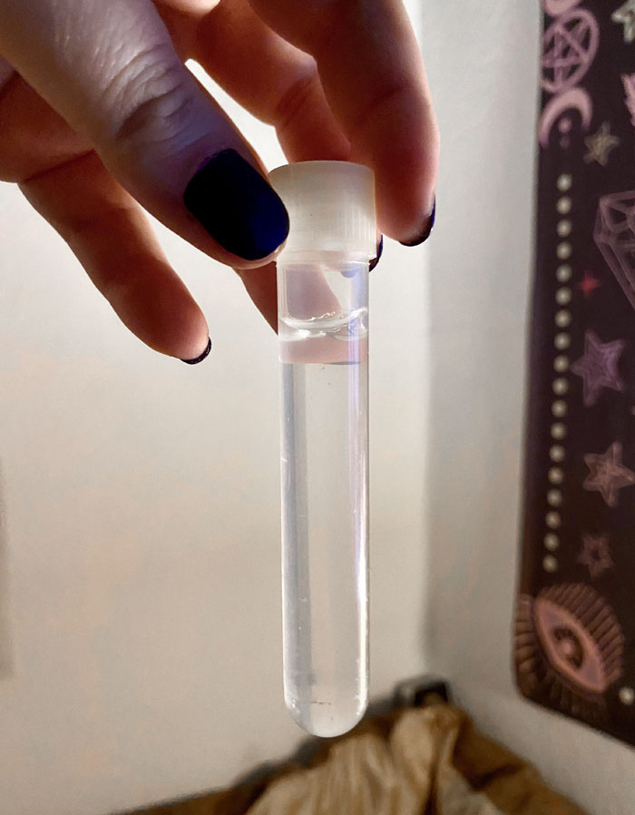 I Have A Tube With My Brain Fluid In It