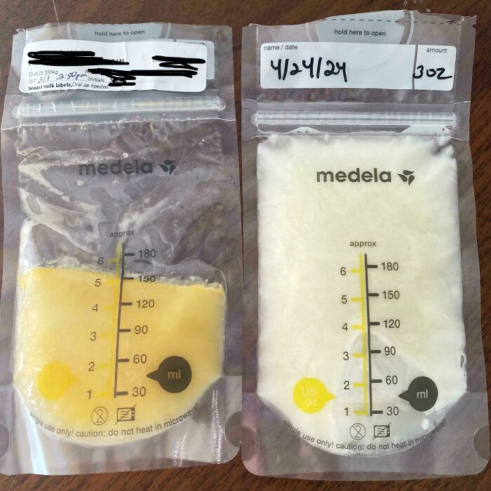 Breast Milk Color Difference 3 Days Postpartum vs. 8 Weeks Postpartum