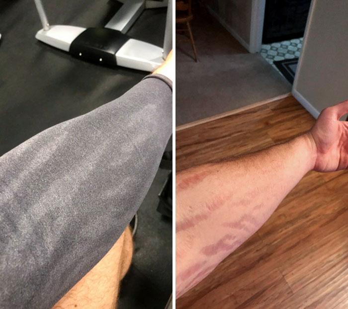 My Scars Don't Seem To Sweat