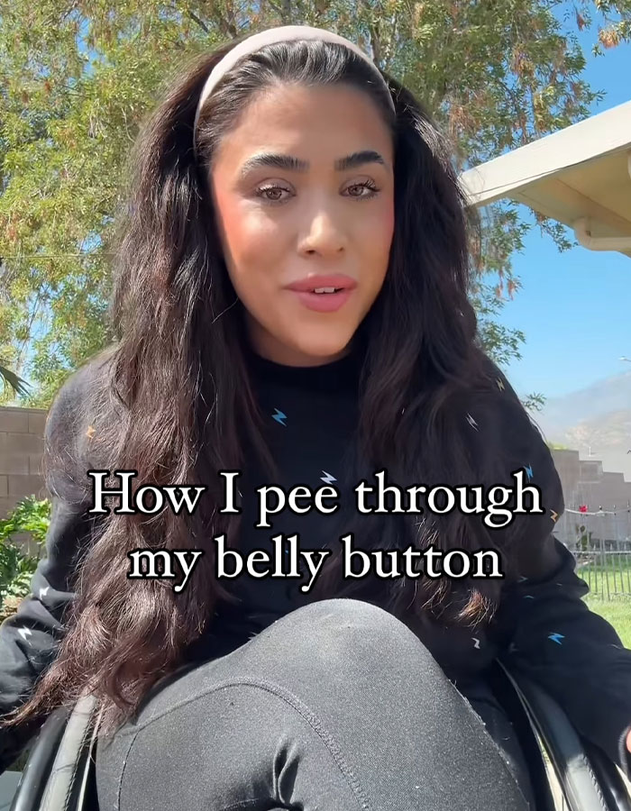 “It Was Worth The Pain”: Quadriplegic Influencer Talks About Peeing Through Her Belly Button “It Was Worth The Pain”: Quadriplegic Influencer Talks About Peeing Through Her Belly Button
