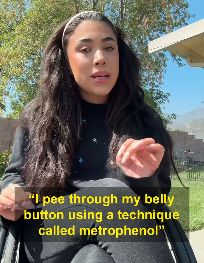 “It Was Worth The Pain”: Quadriplegic Influencer Talks About Peeing Through Her Belly Button “It Was Worth The Pain”: Quadriplegic Influencer Talks About Peeing Through Her Belly Button