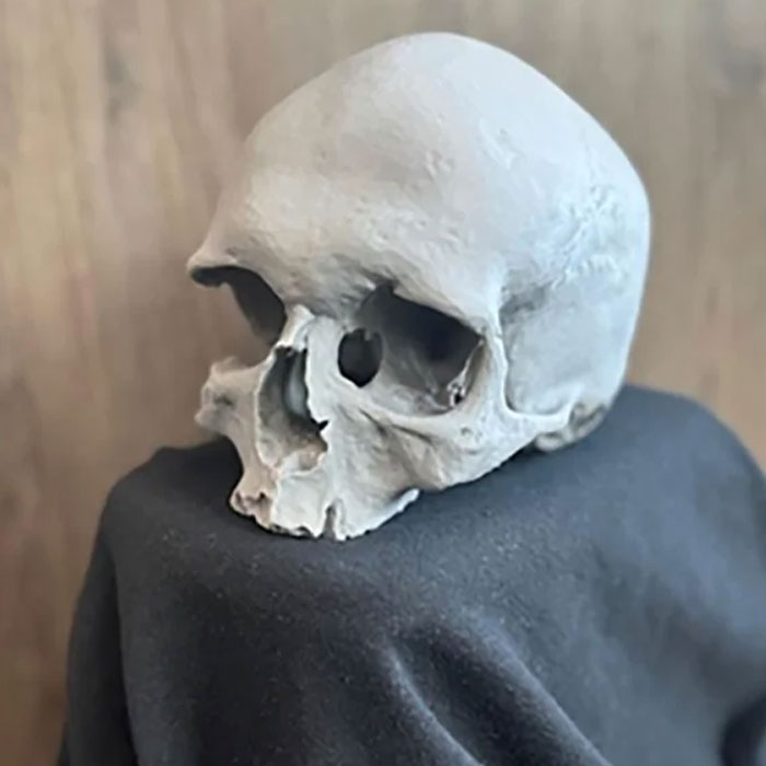 DNA Analysis Solves Mystery Of Human Skull Found During Home Renovations: "Grave Robbing" DNA Analysis Solves Mystery Of Human Skull Found During Home Renovations: "Grave Robbing"