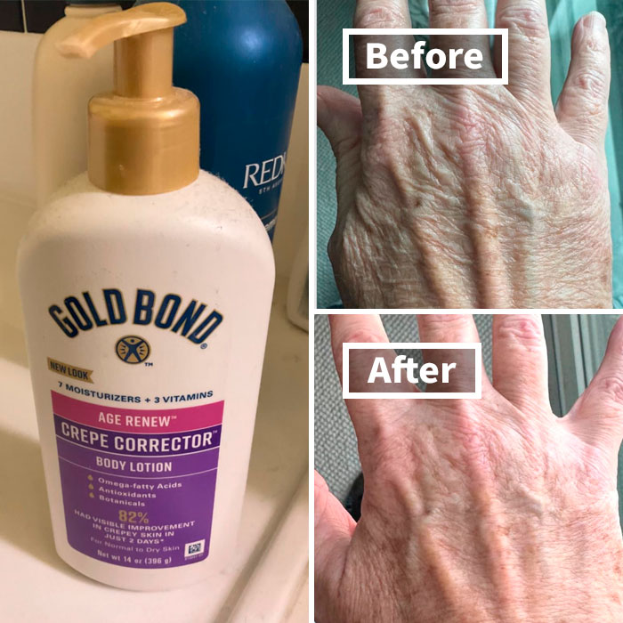 Gold Bond lotion beside before-and-after images of smoother hands addressing winter beauty woes.