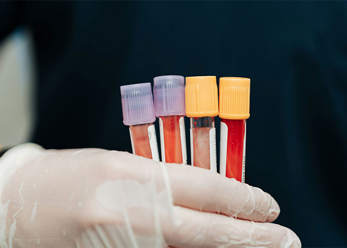 Doctors Share The Wildest Examples Of Correct Self-Diagnoses, Here Are The 30 Best Ones