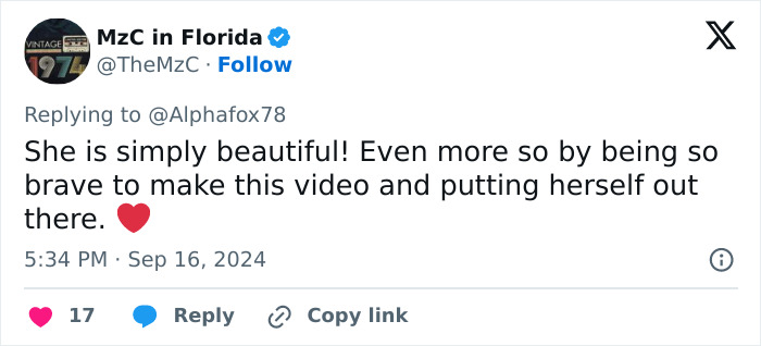 "You Have To Be Kidding Me": Makeup Artist With Alopecia Goes Viral With Stunning Transformations