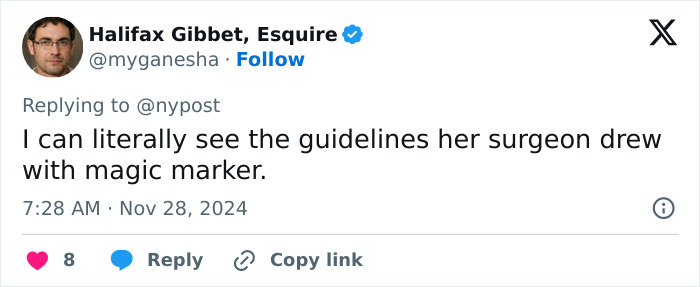 A tweet commenting on Catwoman Jocelyn Wildenstein's appearance and surgery claims. A tweet commenting on Catwoman Jocelyn Wildenstein's appearance and surgery claims.