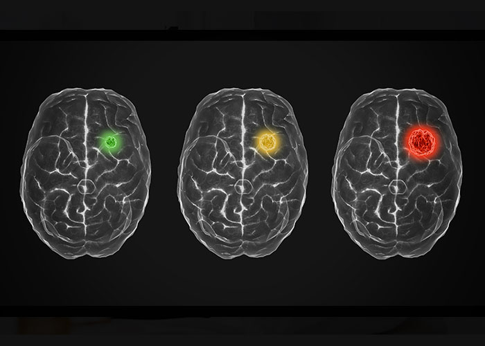 Doctors Share The Wildest Examples Of Correct Self-Diagnoses, Here Are The 30 Best Ones