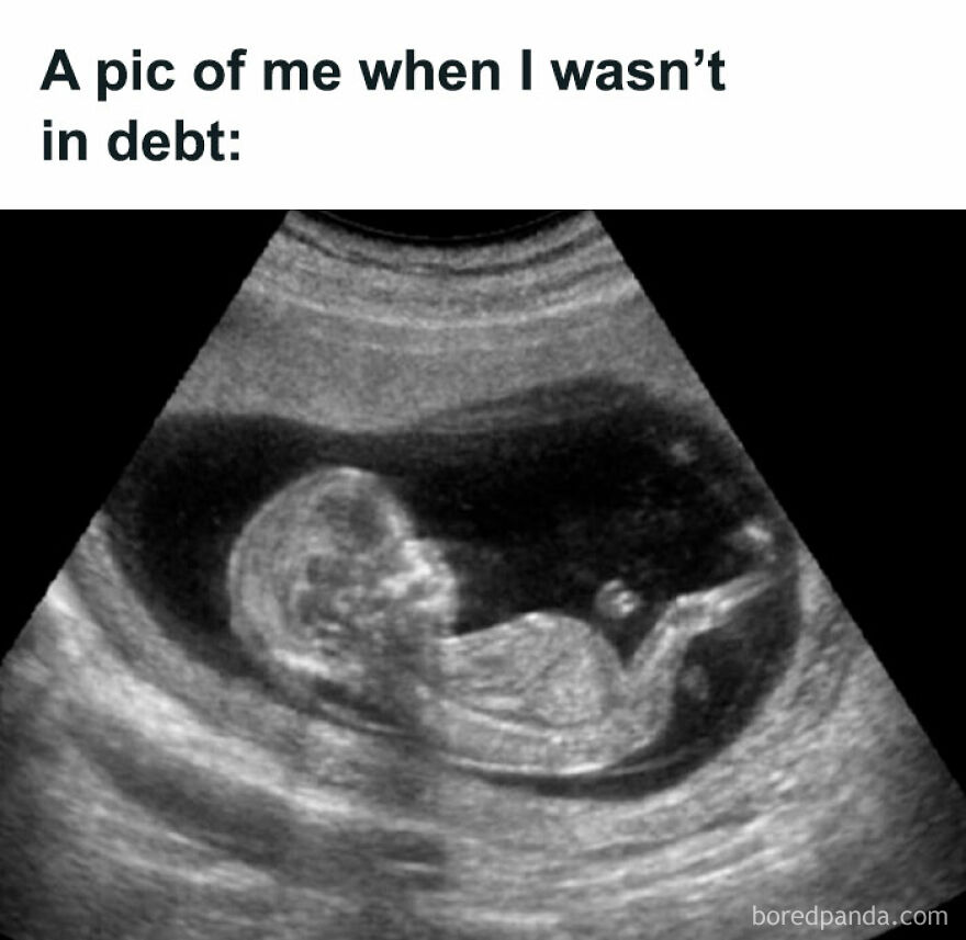 Ultrasound meme with text: "A pic of me when I wasn’t in debt," showcasing funny humor.
