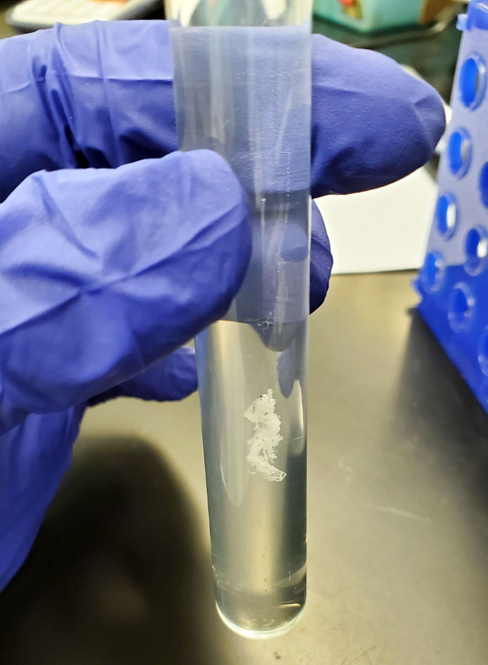 In Case You Have Not Seen What A Clump Of DNA Looks Like