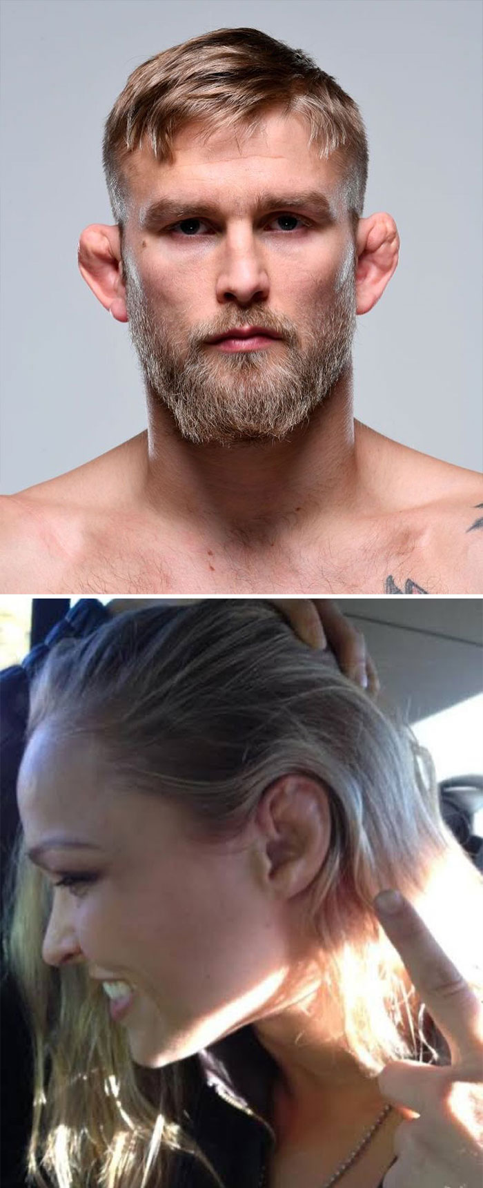 UFC Fighters And Wrestlers Usually Have Enlarged Ears, This Is Called Cauliflower Ear