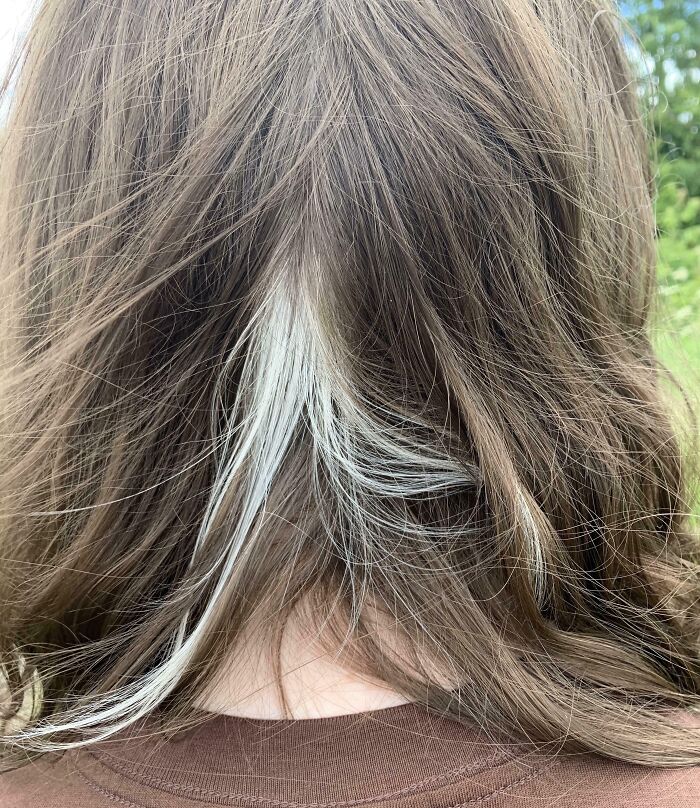 This Patch Of White Hair We Somehow Just Found On My Head Today At Only 20 Years Old