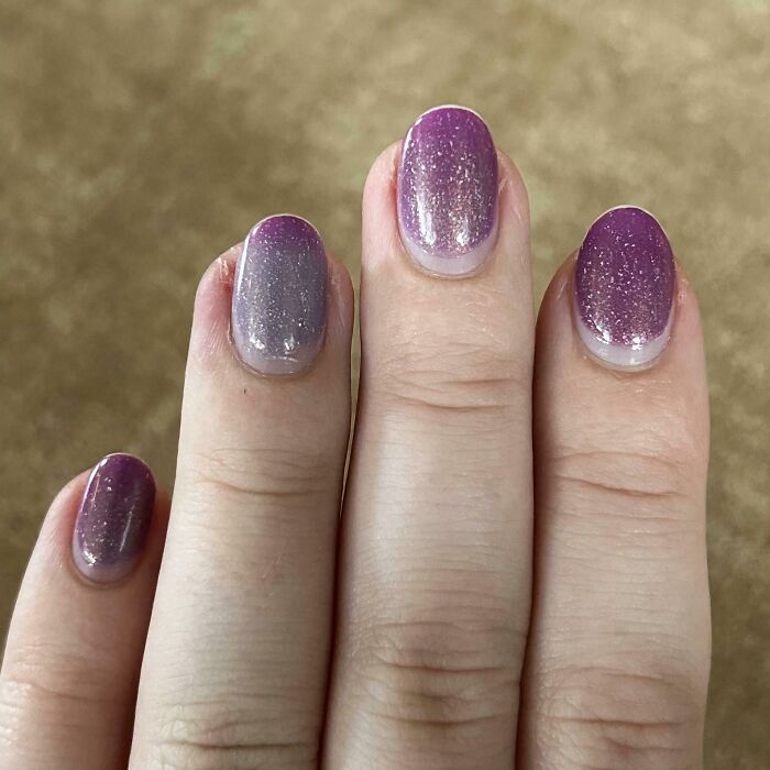 I’m Wearing A Thermal Nail Polish And I Can See How Much Hotter My Infected Ring Finger Is