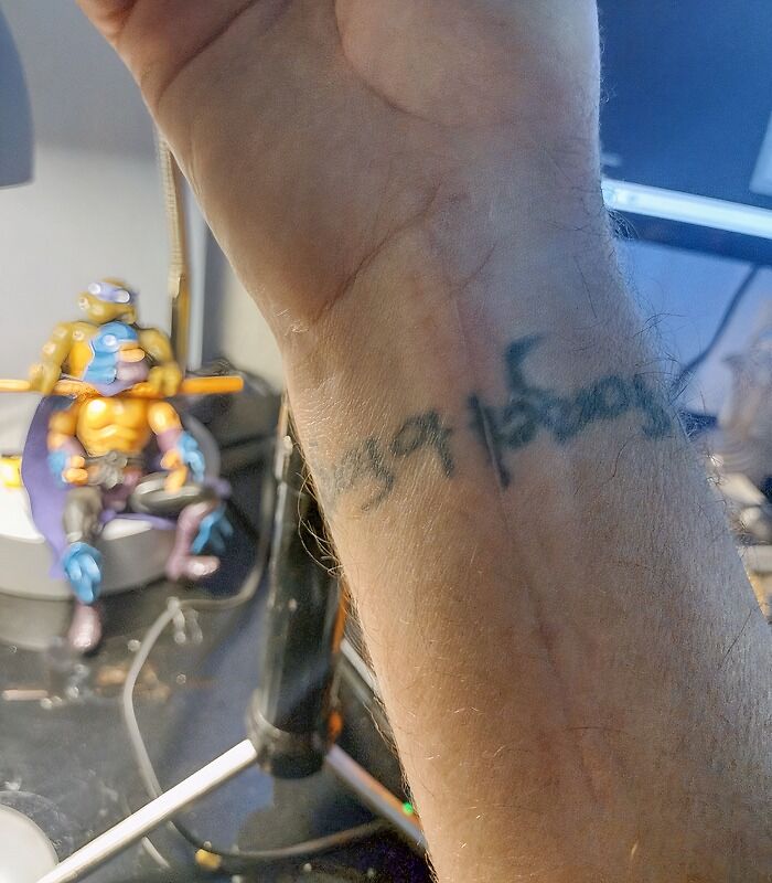 Surgery After My My Radius Fracture Surgery. They Didn't Line My Tattoo Up