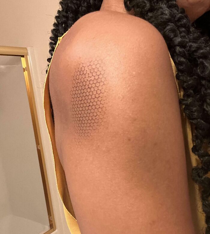 Accidentally Got This Sick Burn From My Space Heater