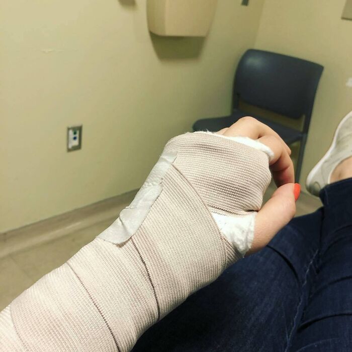 You Break Your Arm In A Foreign Country, Suffer Through A Journey Home Where Airport Security In Two Different Countries Both Bash Around Your Cast In Case It’s Concealing Weapons