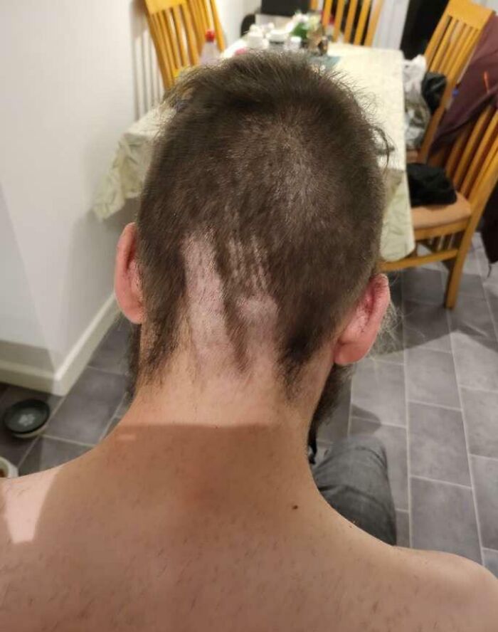 Uneven haircut from a hair-cutting-dyeing-fails attempt, showing patchy shaved areas on the back of a person's head.