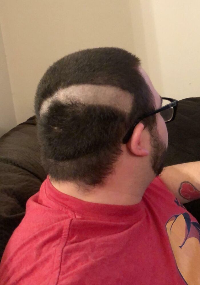 The Razor Edge Broke Off In My Hair And Left Me With The Following