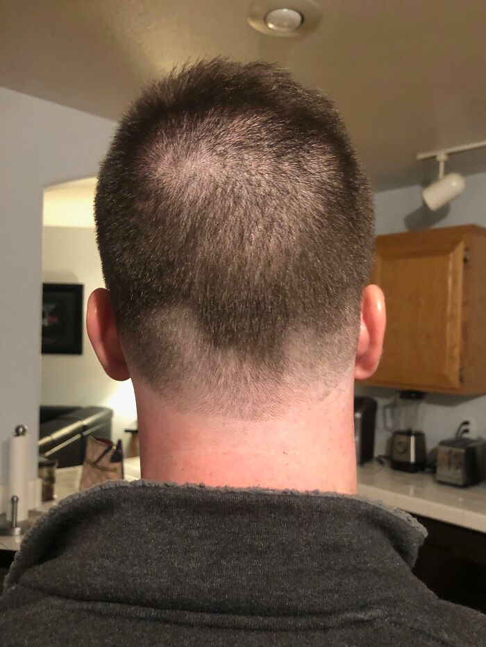 My Boyfriend Decided To Get A $5 Haircut, And It Shows