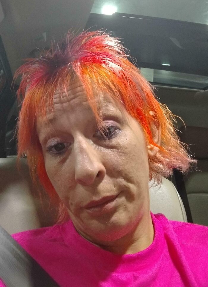 Supongo que tendré que llevar sombrero hasta que vuelva a crecer