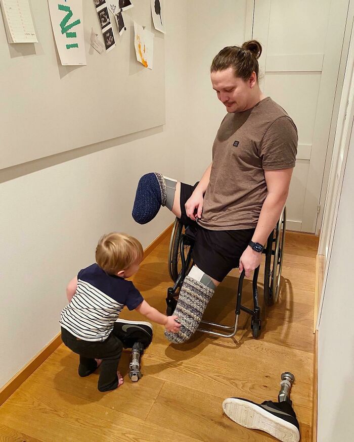 Child helping a man in a wheelchair adjust his prosthetic leg, symbolizing amazing mothers-in-law support and care.