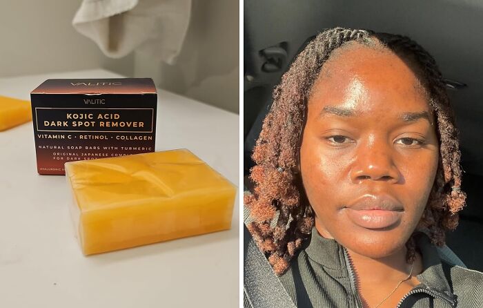 Brighten Up Your Complexion With These Valitic Kojic Acid Dark Spot Remover Soap Bars And Say Goodbye To Those Pesky Dark Spots For Good