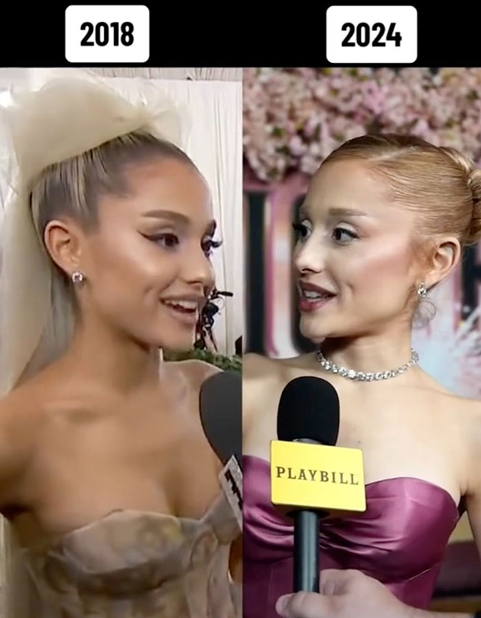 Ariana Grande Sparks New Health Concerns After Appearance At London Premiere Of &lsquo;Wicked&rsquo;