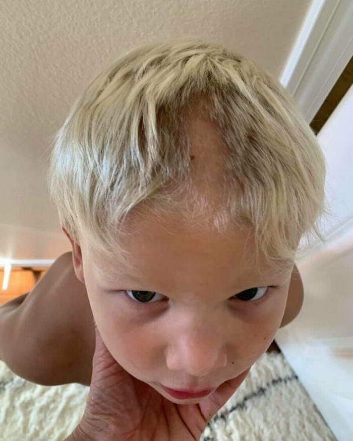 My Friend's Kid Really Likes Cutting His Own Hair. This Is Not The First Time. What Should We Call This?