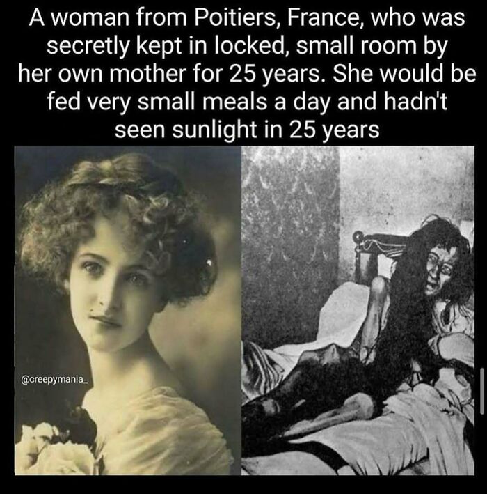 Two photographs of a woman; one elegant and another depicting her gaunt after 25 years of confinement, showcasing weird facts.