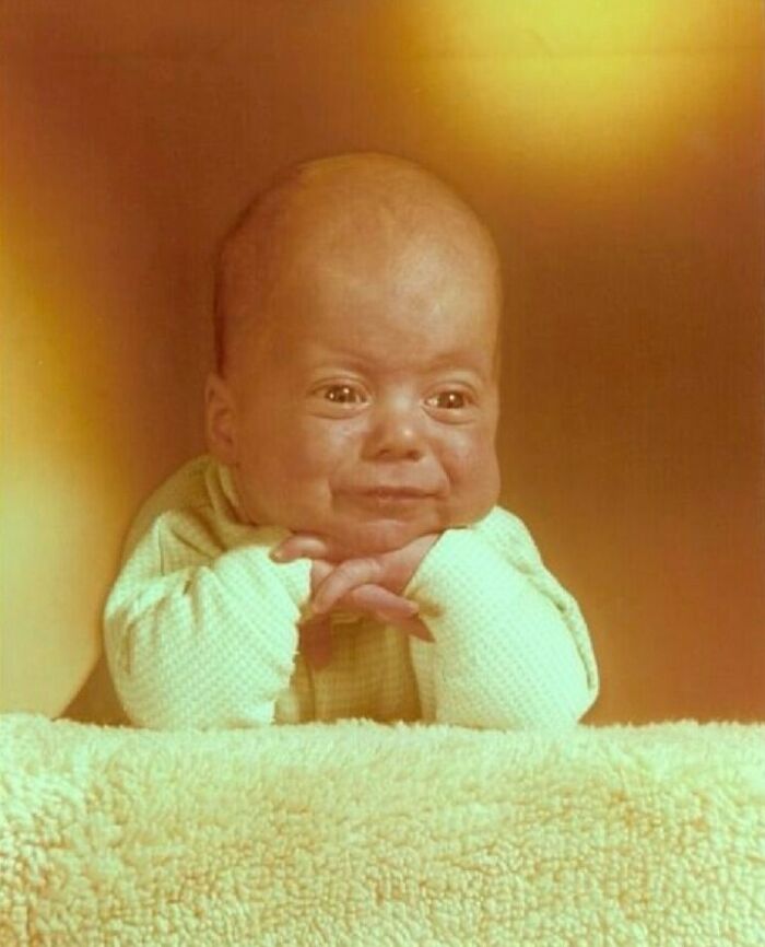 “My Husband As An Infant. I Prayed Our Children Would Not Inherit His Large Cranium.”