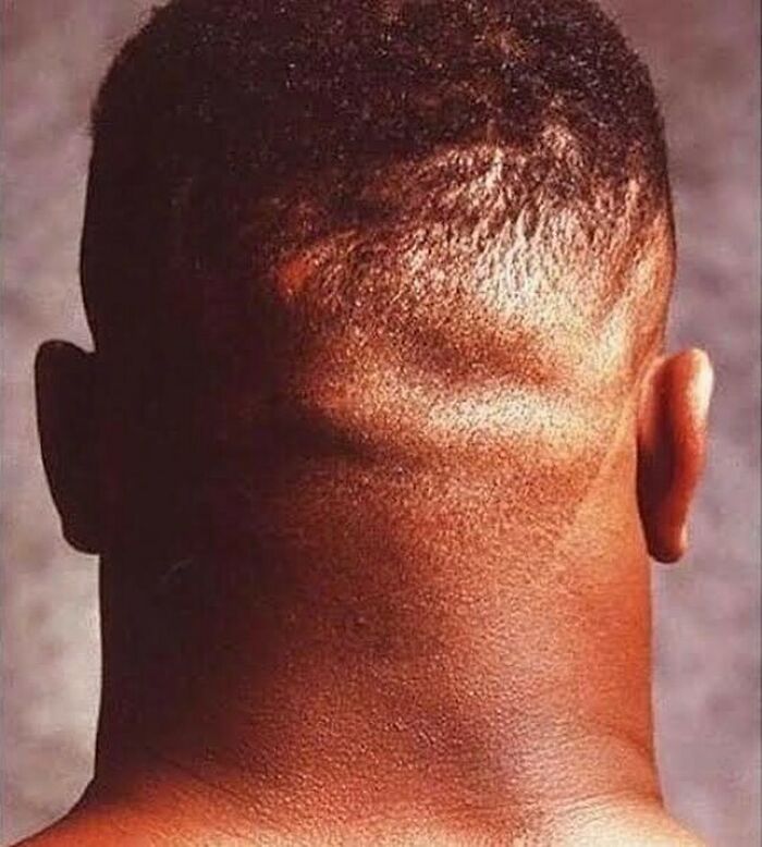 The 20-Inch Humongous Neck Of 18-Year Old Mike Tyson
