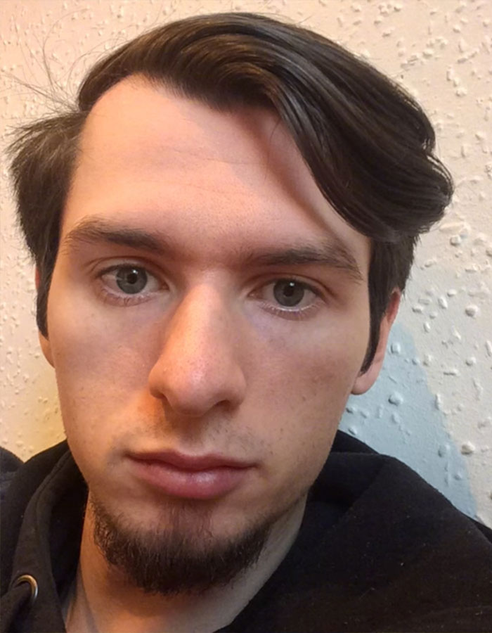 "I Can Smell It From Here": Man Who Hasn't Used Shampoo For 8 Years Reveals Remarkable Results "I Can Smell It From Here": Man Who Hasn't Used Shampoo For 8 Years Reveals Remarkable Results