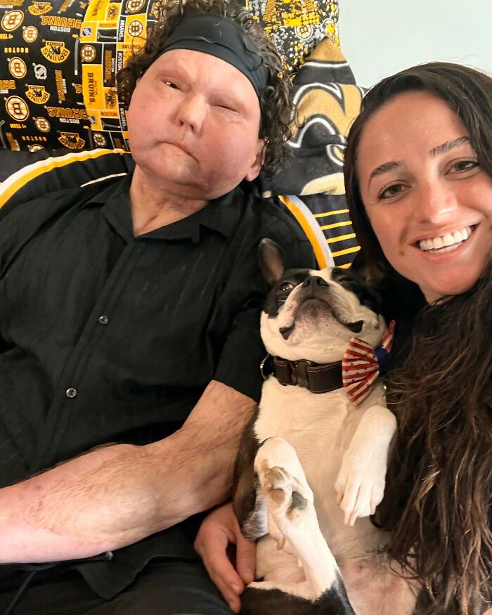 Man Who Had World’s First Face And Hands Transplant Shares Engagement Photos With Fiancée Man Who Had World’s First Face And Hands Transplant Shares Engagement Photos With Fiancée