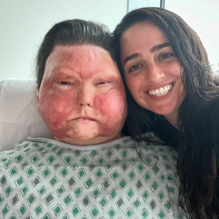 Man Who Had World’s First Face And Hands Transplant Shares Engagement Photos With Fiancée Man Who Had World’s First Face And Hands Transplant Shares Engagement Photos With Fiancée