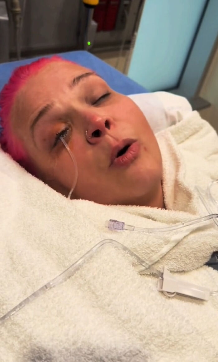 &ldquo;I Started Screaming&rdquo;: Woman Rushed To The Hospital After Mistaking Glue For Eye Drops