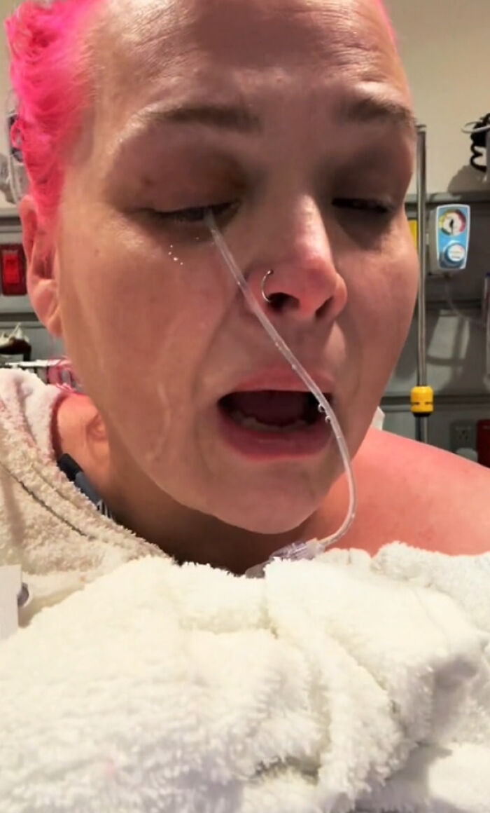 &ldquo;I Started Screaming&rdquo;: Woman Rushed To The Hospital After Mistaking Glue For Eye Drops