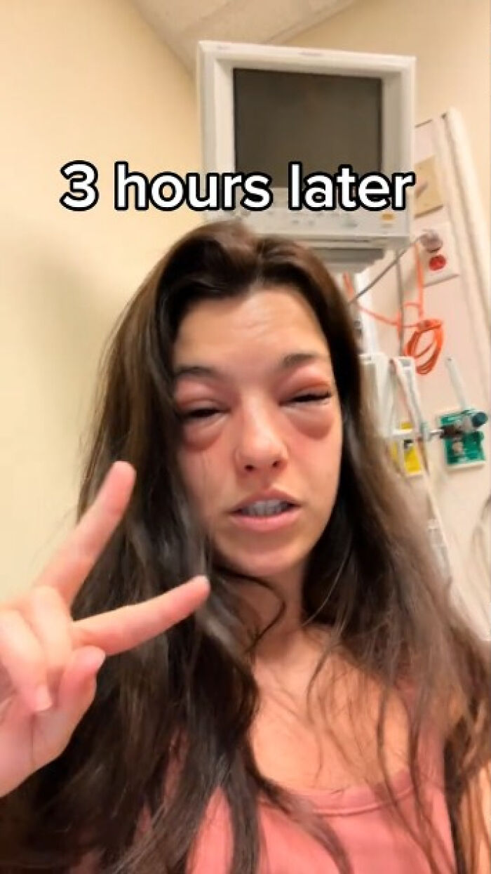 "Crazy": Woman Ends Up In The ER With Swollen Face After Visiting Pickle-Themed Food Festival "Crazy": Woman Ends Up In The ER With Swollen Face After Visiting Pickle-Themed Food Festival