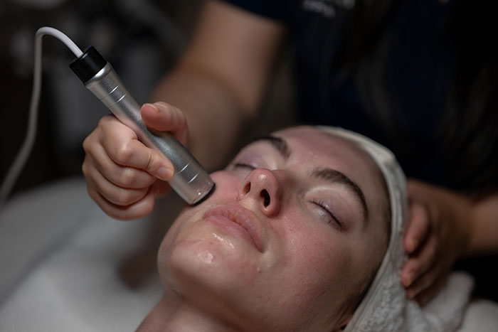 Amid Viral Injuries, Skin Expert Exposes Dangers Of Botched Microneedling Treatments (Exclusive)