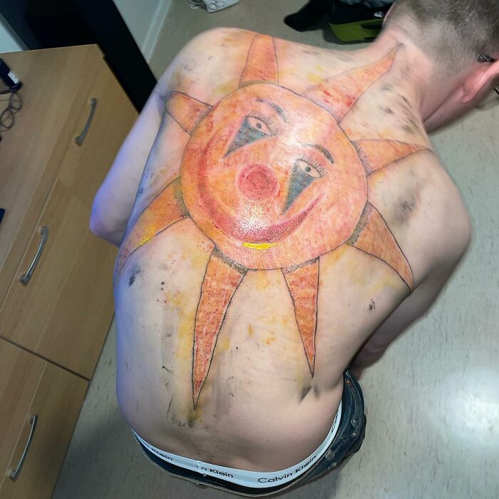 Epic tattoo fail with a large, colorful sun design covering a person's back.