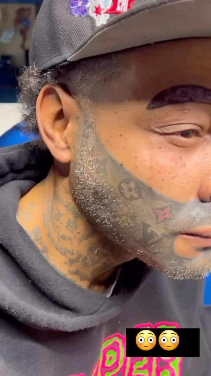 Close-up of a man's face with tattoos covering his cheek and neck, wearing a hat and hoodie.
