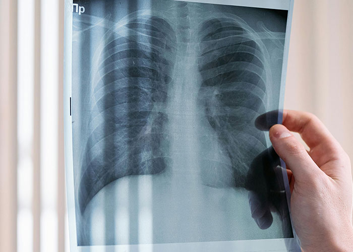 &ldquo;I Don&rsquo;t Know What To Do&rdquo;: Man In Fear Of Losing A Longtime Friend Over Her BF Of 5 Months