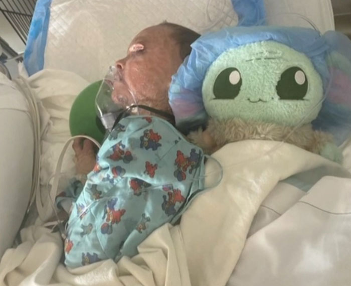"Absolute Nightmare": 7YO With Rare Condition Sleeps With His Eyes Closed For The First Time