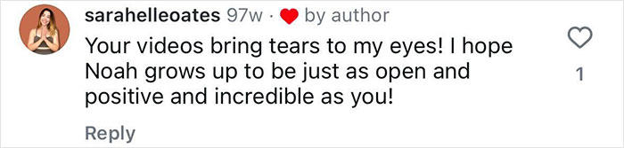 "Ashamed And Embarrassed": Man Without An Anus Reveals His Peculiar Bowel Habits