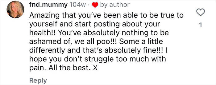 "Ashamed And Embarrassed": Man Without An Anus Reveals His Peculiar Bowel Habits