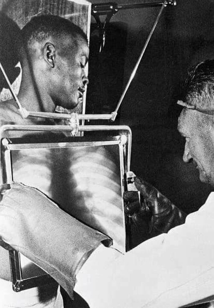A Diamond Mine Worker Is X-Rayed At The End Of Each Shift Before Leaving The Mines. South Africa, 1954